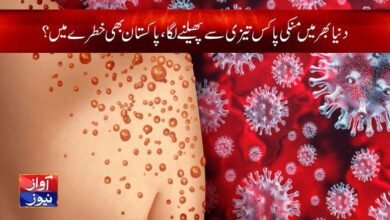 monkeypox symptoms and treatment in urdu