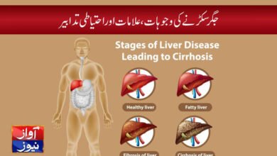 liver cirrhosis symptoms in urdu