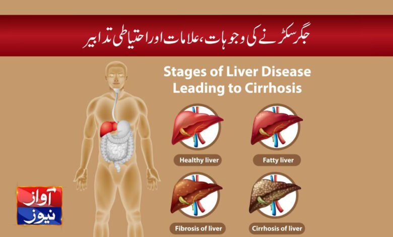 liver cirrhosis symptoms in urdu